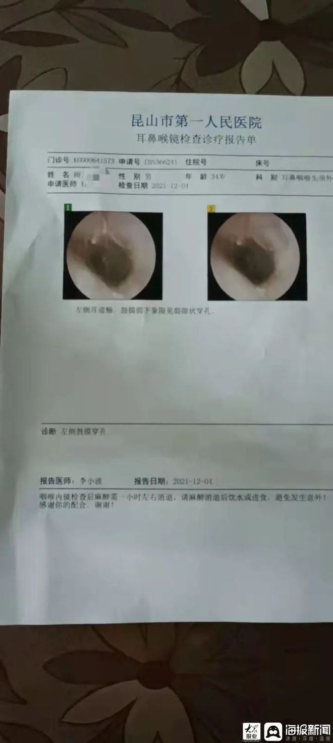 耳膜穿孔最新轻伤标准详解